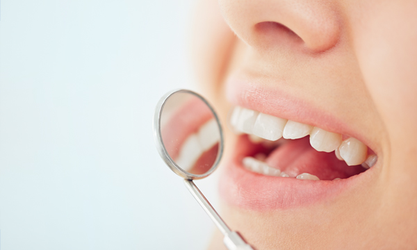 Malattie Dentali